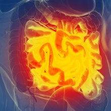 Cannabis for Gastrointestinal Disorders