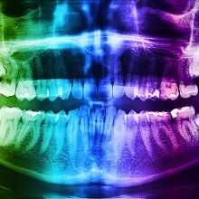 CBD Dentistry